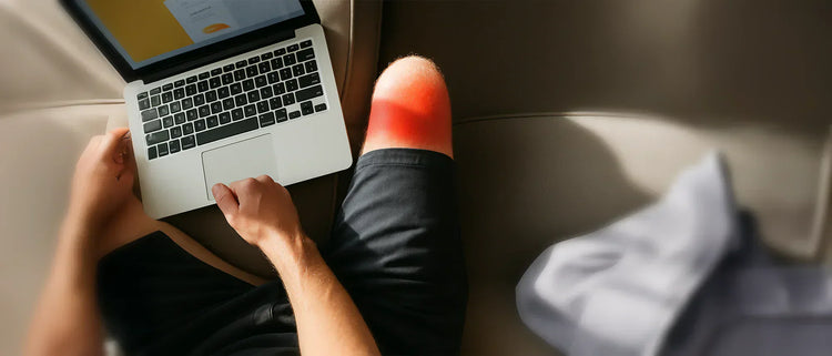 Are Your Thighs Getting Burned by Your Laptop